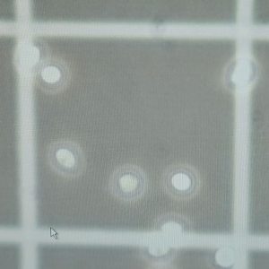 현미경으로 바라본 미생물